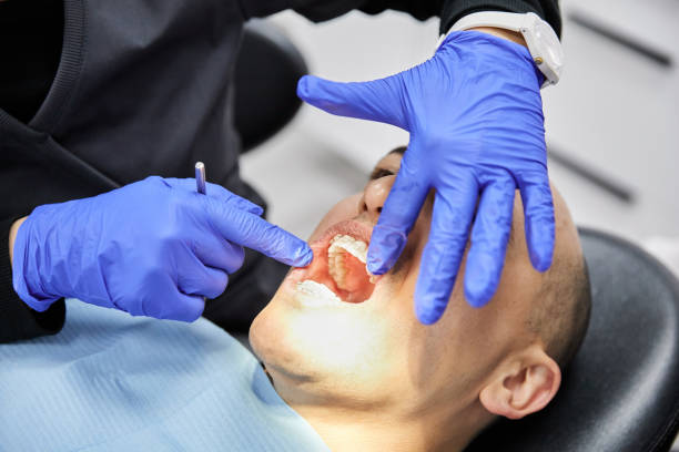 Best Broken Tooth Emergency  in Placerville, CA